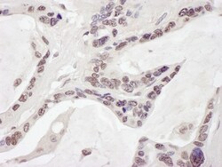ARID1B Antibody, Novus Biologicals 100 &mu;L | Buy Online | Novus Biologicals | Fisher Scientific